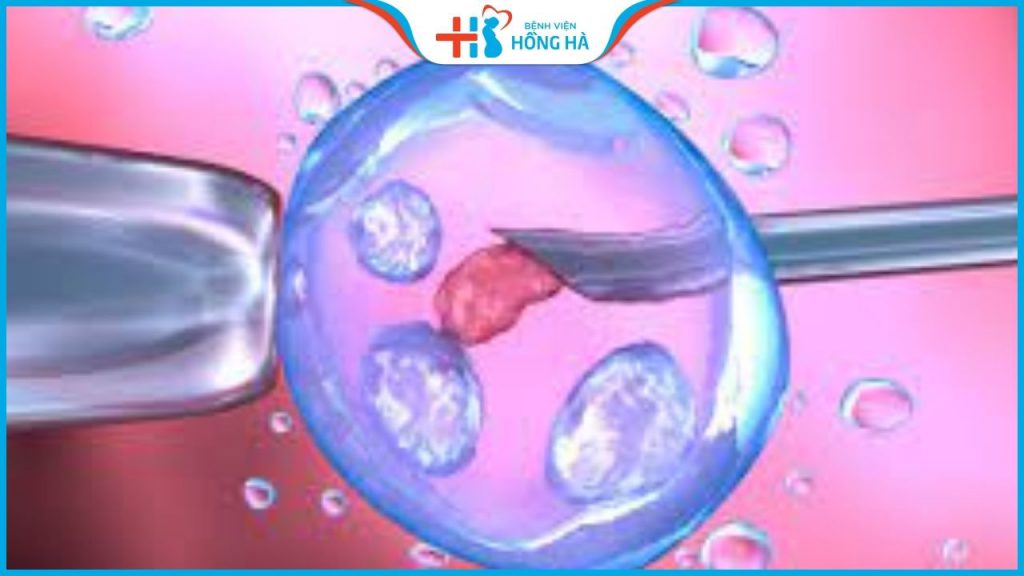 Thụ tinh nhân tạo: Giải pháp hiệu quả cho những cặp vô sinh