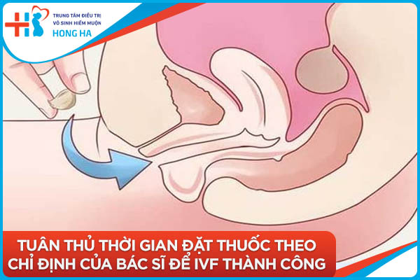 Kinh nghiệm IVF thành công