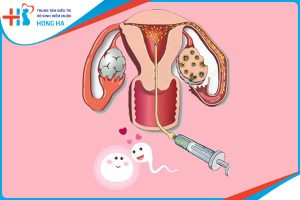 Quy trình thụ tinh nhân tạo – Cách thức và địa chỉ thực hiện uy tín