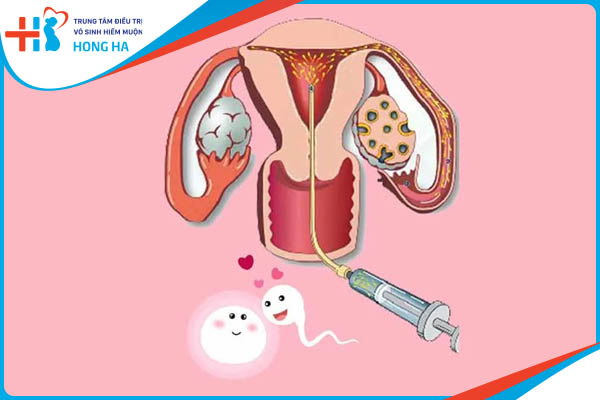 Quy trình thụ tinh nhân tạo – Cách thức và địa chỉ thực hiện uy tín