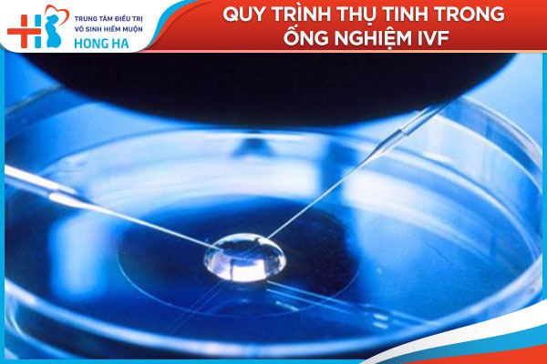 Quy trình thụ tinh trong ống nghiệm IVF: Tỉ lệ thành công và yếu tố ảnh hưởng
