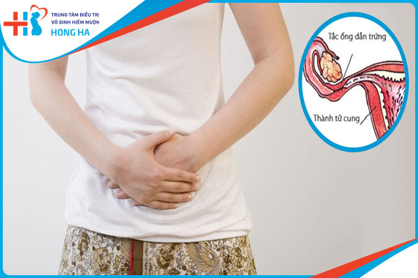 Siêu âm đầu dò phát hiện tắc vòi trứng với độ chính xác 90%