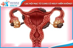 Lạc nội mạc tử cung: Nguy hiểm và tác động đến khả năng mang thai