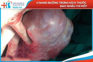 Mổ u nang buồng trứng: 2 phương pháp hiệu quả điều trị và một số lưu ý
