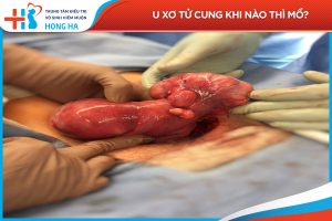 Mổ u xơ tử cung thành công 95%: Phục hồi và lưu ý sau phẫu thuật