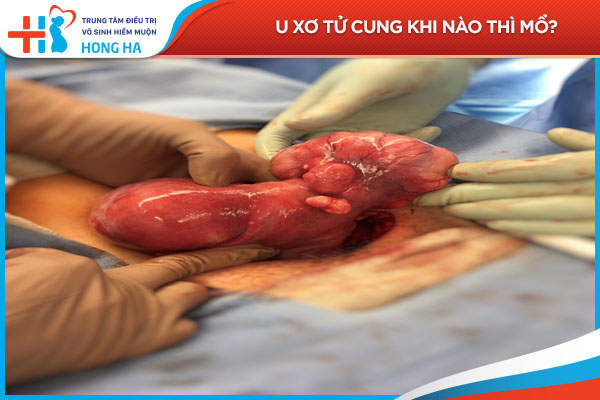 Mổ u xơ tử cung thành công 95%: Phục hồi và lưu ý sau phẫu thuật