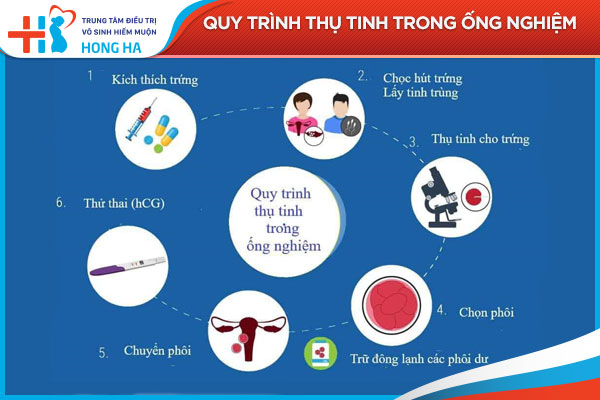 Những yếu tố ảnh hưởng đến thời gian thực hiện thụ tinh ống nghiệm