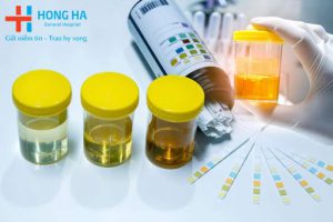 DỊCH VỤ CHO THUÊ XE XQUANG LƯU ĐỘNG