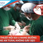 Chăm sóc sau mổ u nang buồng trứng: Kinh nghiệm 90% phục hồi nhanh