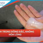 Tối ưu tinh trùng yếu – Phương pháp hiệu quả & chuyên gia đáng tin