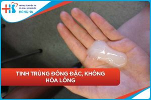 Tối ưu tinh trùng yếu – Phương pháp hiệu quả & chuyên gia đáng tin