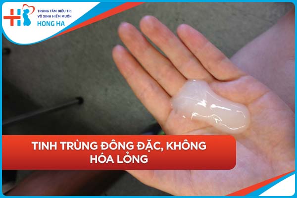Tối ưu tinh trùng yếu – Phương pháp hiệu quả & chuyên gia đáng tin