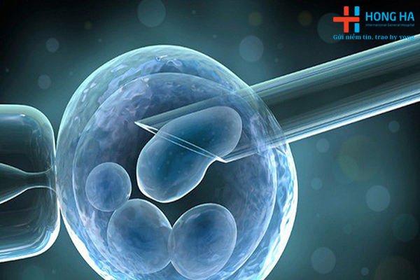 Quy trình thụ tinh ống nghiệm IVF