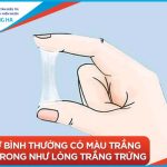 Khí hư có màu nâu: Nguyên nhân và giải pháp xử lý hiệu quả