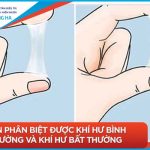 Khí hư màu vàng và tác động của nó đến sức khỏe phụ nữ