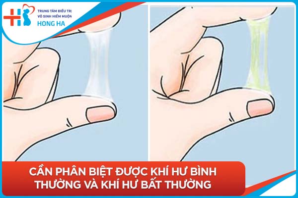 Khí hư màu vàng và tác động của nó đến sức khỏe phụ nữ