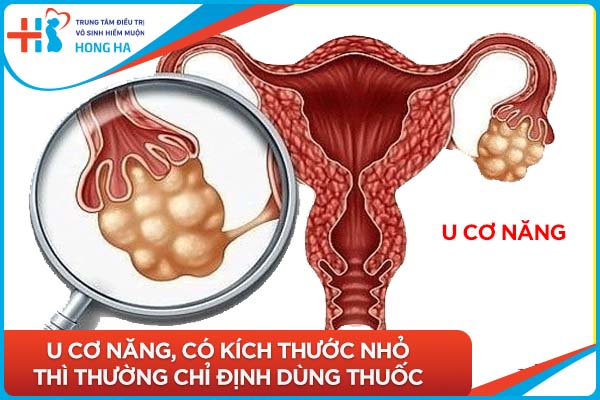 Thuốc trị u nang buồng trứng hiệu quả đến 90%: Tìm hiểu ngay