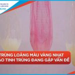 Tình trạng tinh trùng loãng màu vàng: Nguyên nhân và cách điều trị