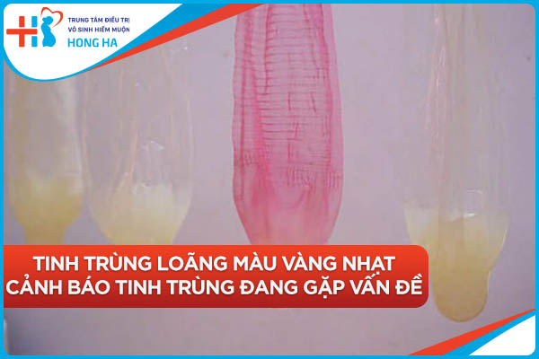 Tình trạng tinh trùng loãng màu vàng: Nguyên nhân và cách điều trị