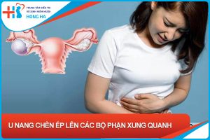 U nang buồng trứng: Tìm hiểu về rủi ro và nguy hiểm