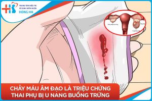 U nang buồng trứng và những thay đổi trong quá trình mang thai