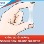 Nguyên nhân và điều trị khi ra nhiều khí hư màu trắng ở nữ giới