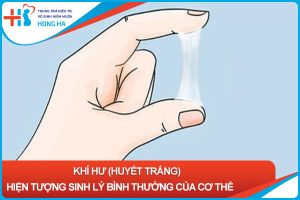 Nguyên nhân và điều trị khi ra nhiều khí hư màu trắng ở nữ giới