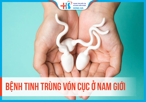 Các phương pháp chẩn đoán và điều trị tinh trùng vón cục