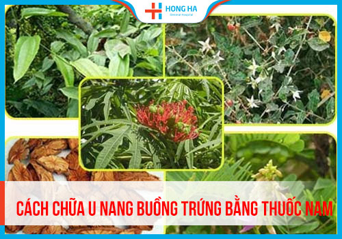 Giải đáp những thắc mắc về việc chữa u nang buồng trứng bằng thuốc nam