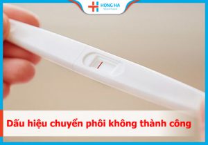 3 Dấu hiệu chuyển phôi thất bại và những biểu hiện cần chú ý
