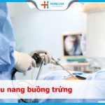 Mổ u nang buồng trứng  – Những điều cần biết trước và sau phẫu thuật