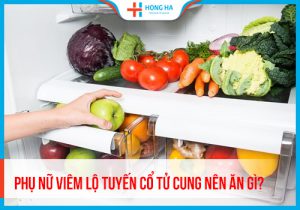 7 Thực phẩm phù hợp để hỗ trợ điều trị viêm lộ tuyến cổ tử cung