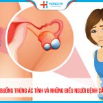 Nguyên nhân u nang buồng trứng ác tính và cách phòng ngừa bệnh hiệu quả