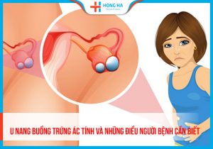 Nguyên nhân u nang buồng trứng ác tính và cách phòng ngừa bệnh hiệu quả