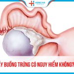 U nang nhầy buồng trứng: Nguyên nhân, triệu chứng và điều trị