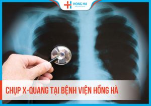 Chụp X-quang là gì? Những thông tin hữu ích cần biết