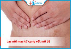 Quá trình phục hồi sau phẫu thuật mổ đẻ lạc nội mạc tử cung