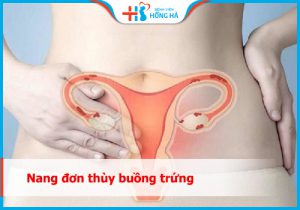 Nang đơn thùy buồng trứng: Nguyên nhân, triệu chứng và điều trị hiệu quả