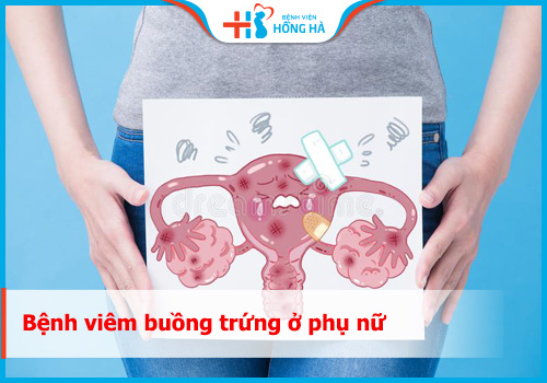 Bảo vệ sức khỏe phụ nữ: Tránh được 80% viêm buồng trứng