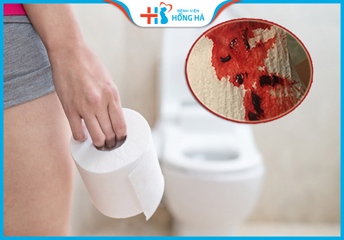 vỡ nang buồng trứng xuất huyết 