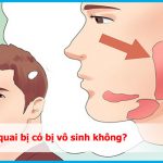 Bị quai bị có bị vô sinh không? Dấu hiệu, Tỷ lệ là bao nhiêu%?