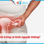 Tác động của tắc vòi trứng đến sức khỏe sinh sản nữ khi kinh nguyệt đến