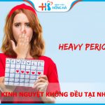 15 phương pháp chữa kinh nguyệt không đều tại nhà hiệu quả nhất