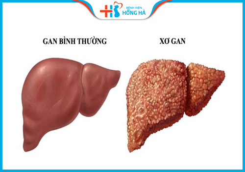 uống cà gai leo có bị vô sinh không