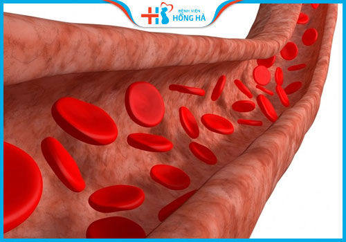 điều trị vô sinh bằng châm cứu tăng lưu thông máu