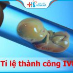 Những kỹ thuật giúp tỉ lệ thành công IVF đạt TỐI ĐA – 7 yếu tố quyết định thụ tinh ống nghiệm