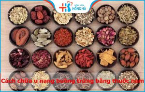 Phương pháp chữa u nang buồng trứng bằng thuốc nam hiệu quả