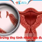 Sau khi cắt 2 vòi trứng thụ tinh nhân tạo được không? Bật mí từ bác sĩ