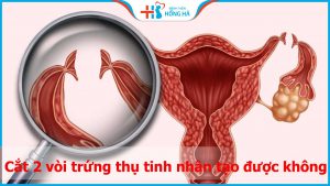 Sau khi cắt 2 vòi trứng thụ tinh nhân tạo được không? Bật mí từ bác sĩ
