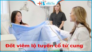 Đốt viêm lộ tuyến cổ tử cung bằng phương pháp an toàn và hiệu quả